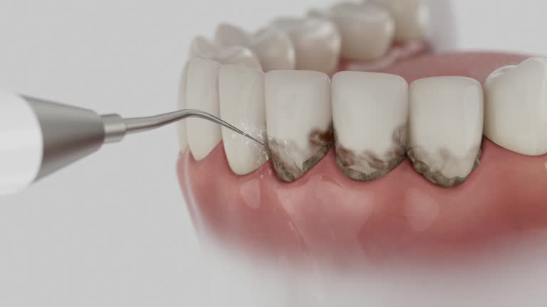 Trusted Teeth Cleaning And Checkup service in Lumberton, MS - Dentist Open Now